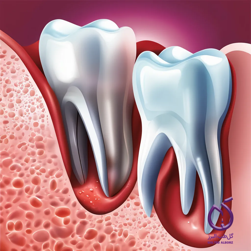 احیای مجدد پالپ دندانی با روش های نوین مثل استرس مثبت